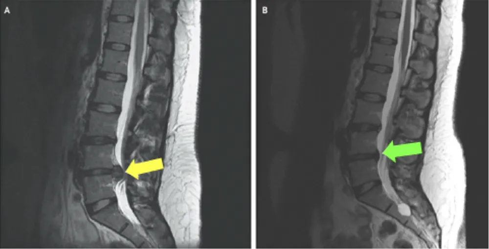 What Can an MRI Show?