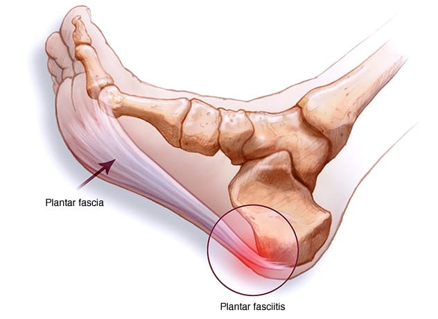 Plantar fascia