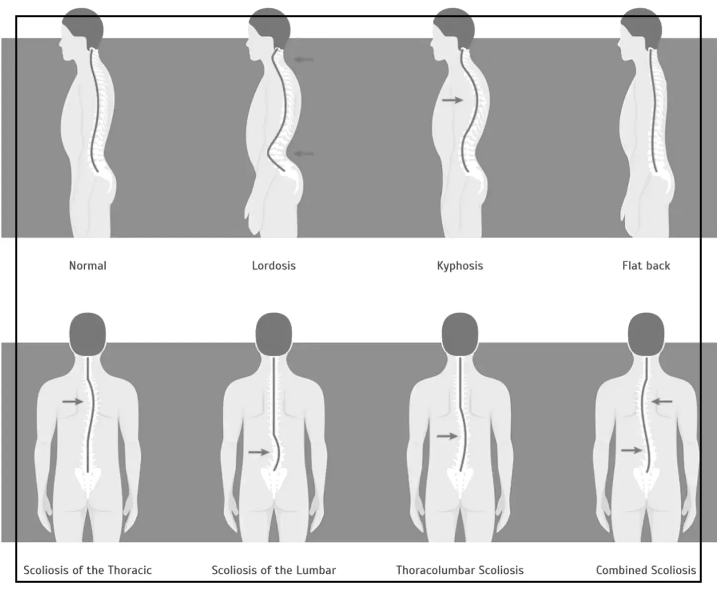 Causes of Lower Back Pain