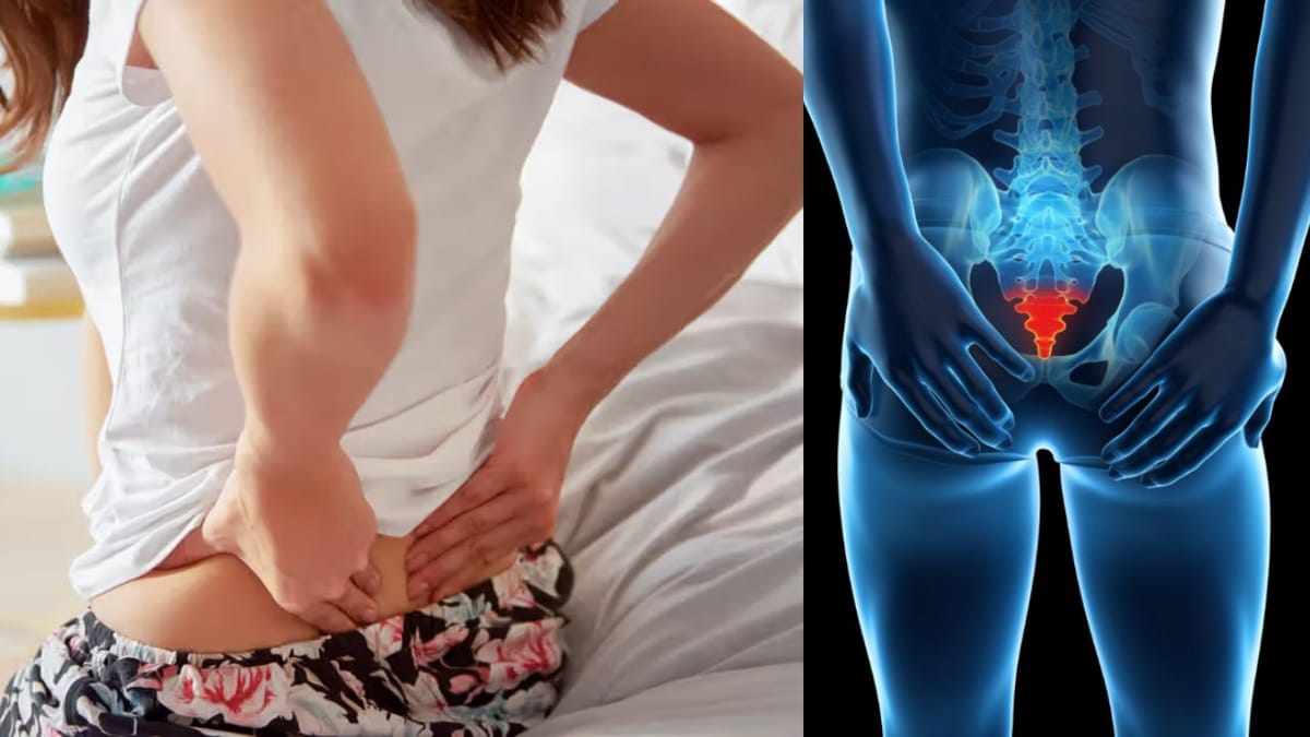 Problems with Coccyx Pain - Causes, Symptoms & Solutions