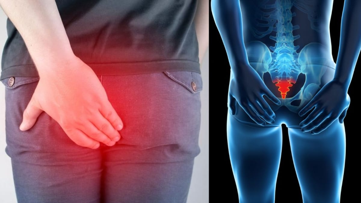 Why Does Tailbone Pain Occur? Causes, Symptoms, & Tips