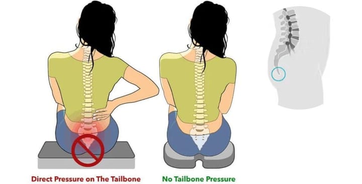 Tailbone Sticks Out
